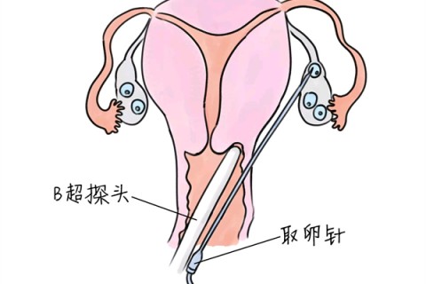 http://foshan.huochezhan.net/post/205.html|佛山供卵助孕