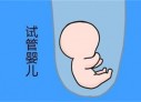 培养佛山捐卵宝宝艺术细胞的小技巧